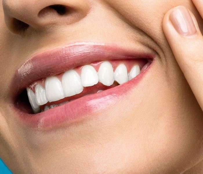 Estética dental en Soto de la Moraleja